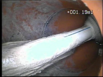 spadlý předmět v kanalizaci